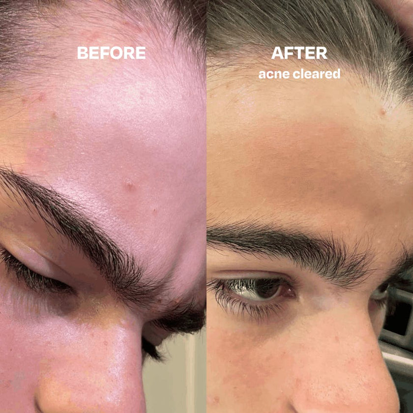Skin Saver Duo