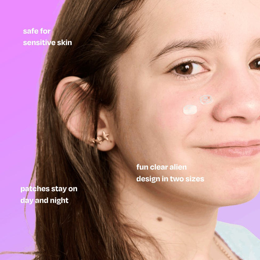 Hands-Off Pimple Patches