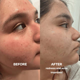 Skin Saver Duo