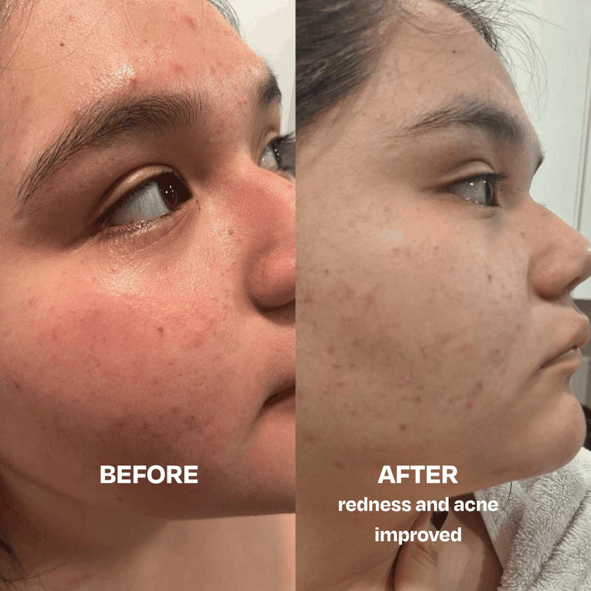 Skin Saver Duo