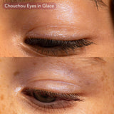 The Glow Kit old