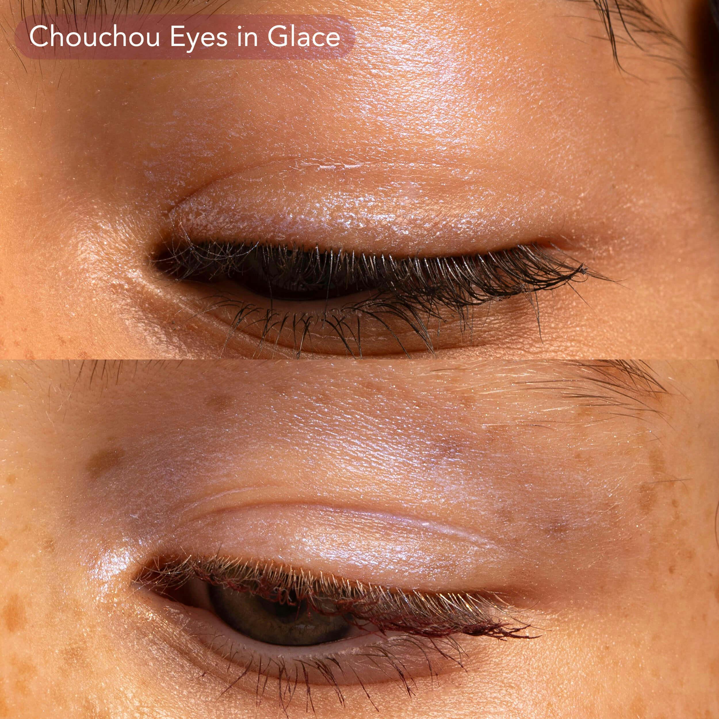 The Glow Kit old