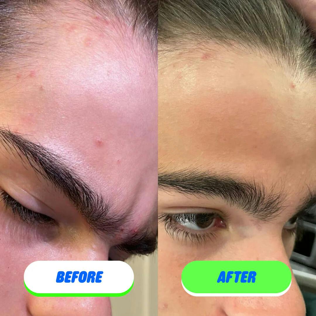Skin Saver